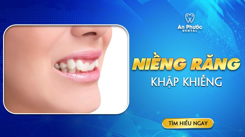 Niềng răng khập khiễng