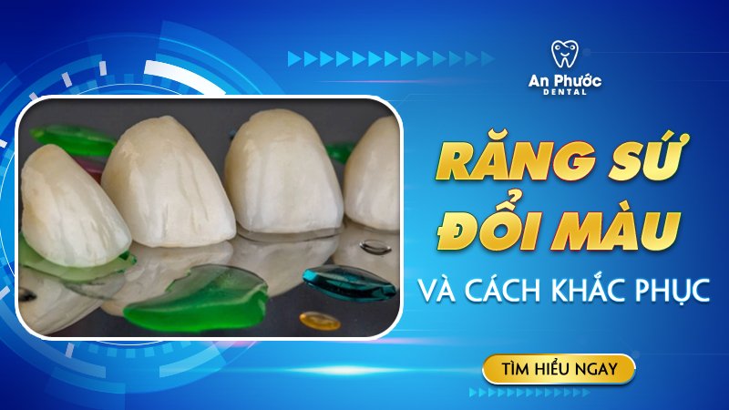 Tại sao răng sứ bị đổi màu? Khắc phục như thế nào? Răng sứ đổi màu và cách khắc phục