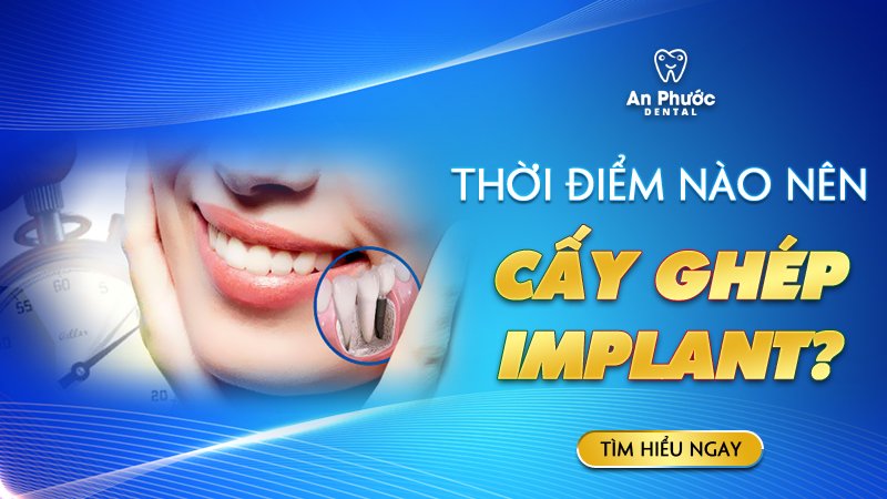 Thời điểm cấy ghép răng Implant khi nào là tốt nhất? Thời điểm nào nên cấy ghép Implant