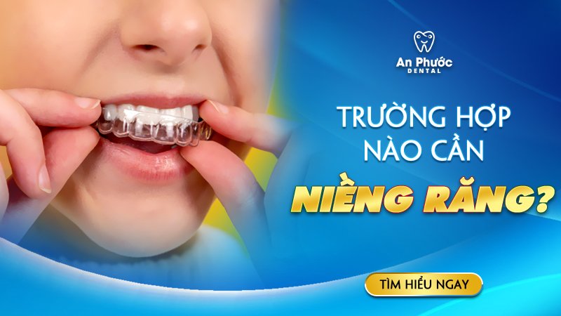 Nên niềng răng trong trường hợp nào để mang lại hiệu quả? Trường hợp nào cần niềng răng