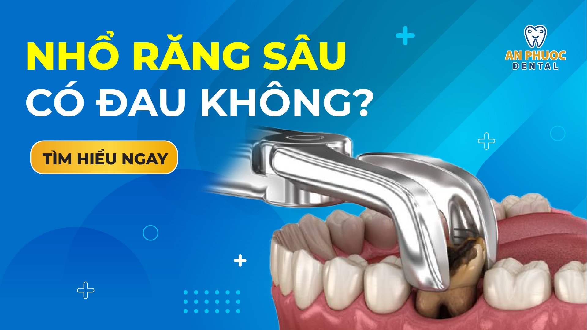 z5078986564031 af3f3f373329c92a458b33b40a890f07 Tháng mười một 5, 2025