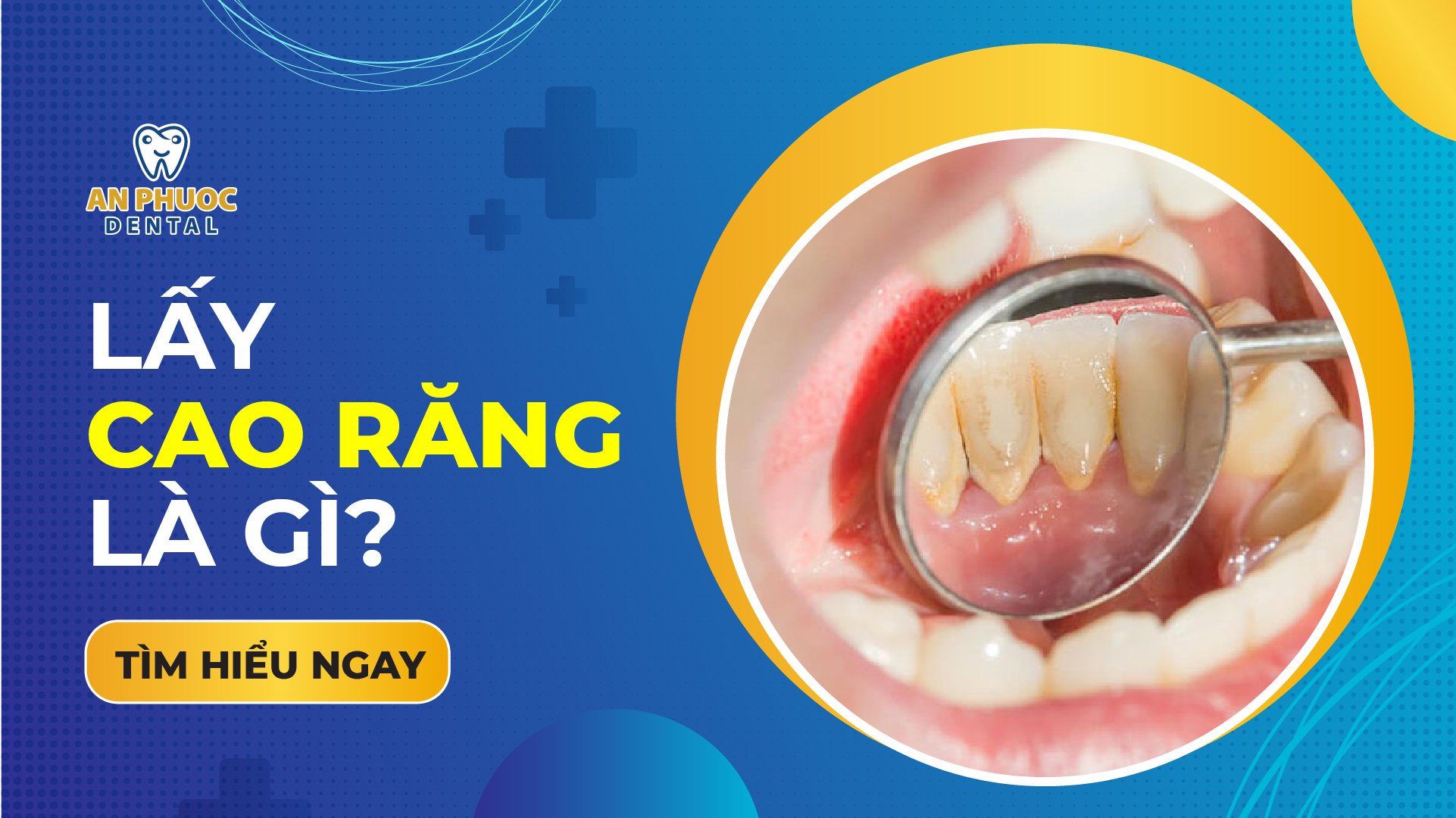 z5078986568373 f76da54e036e05e4e052f73a690c7f7b Tháng mười một 5, 2025