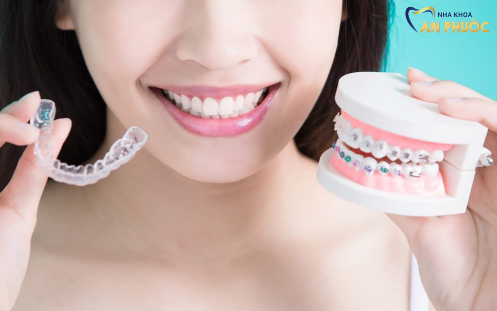 Quy trình niềng răng tại nha khoa An Phước