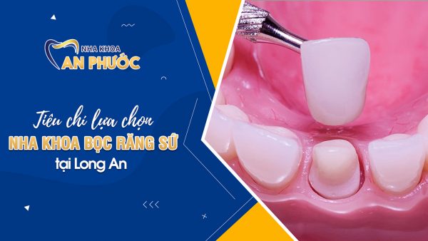 Cách chọn địa chỉ bọc răng sứ uy tín tại Long An boc rang su 2