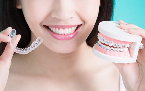 Răng khập khiễng phải làm sao? Niềng răng khập khiễng mất bao lâu?