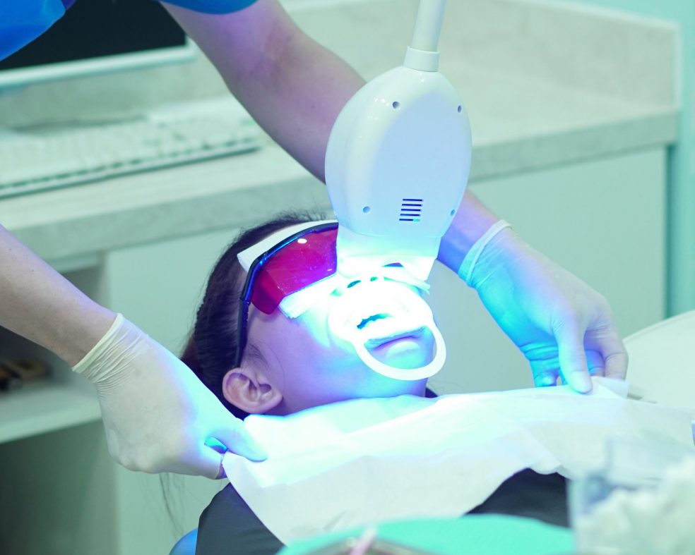 Tẩy trắng răng có ảnh hưởng và có hại gì không?