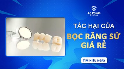 Những tác hại của việc bọc răng sứ giá rẻ tac-hai-cua-boc-rang-su-gia-re