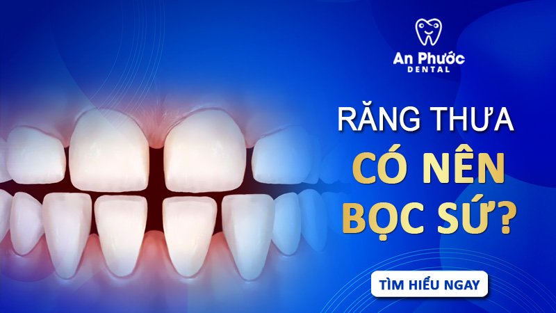 Răng thưa bọc sứ có mang lại hiệu quả không? rang-thua-co-nen-boc-su