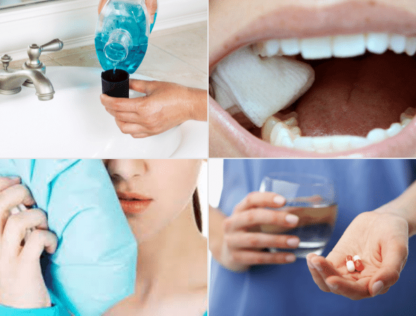 Chăm sóc răng miệng sau khi cấy implant