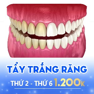 TAY TRANG RANG(1)