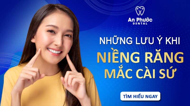 Những lưu ý khi niềng răng mắc cài sứ nhung-luu-y-khi-nieng-rang-mac-cai-su