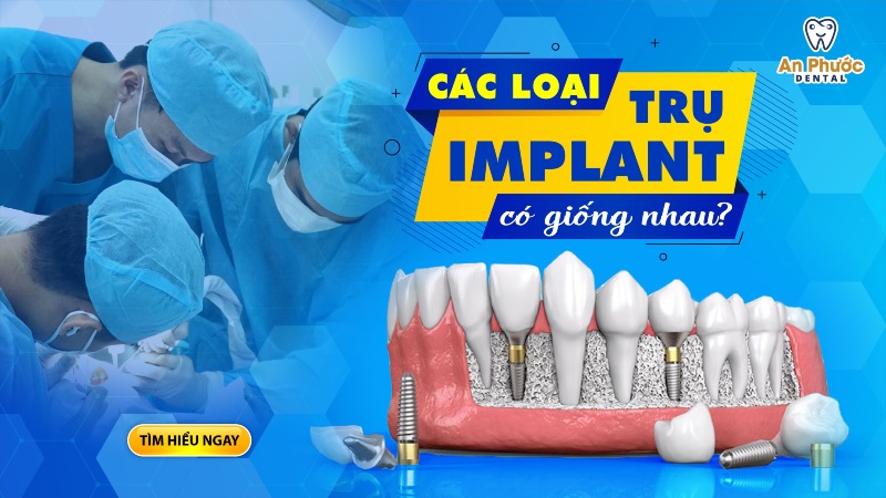 Có phải tất cả các trụ Implant đều giống nhau?