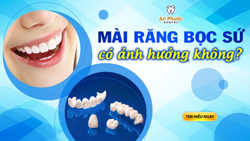 Thực tế mài răng bọc sứ có ảnh hưởng gì không?