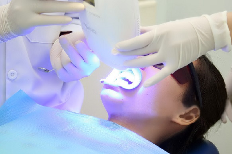 Răng nhiễm fluor là gì? Nguyên nhân và cách khắc phục hiệu quả Laser tẩy trắng răng
