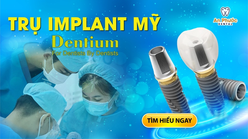 Trụ Implant Mỹ Dentium – Trụ Implant chất lượng cao từ châu Âu
