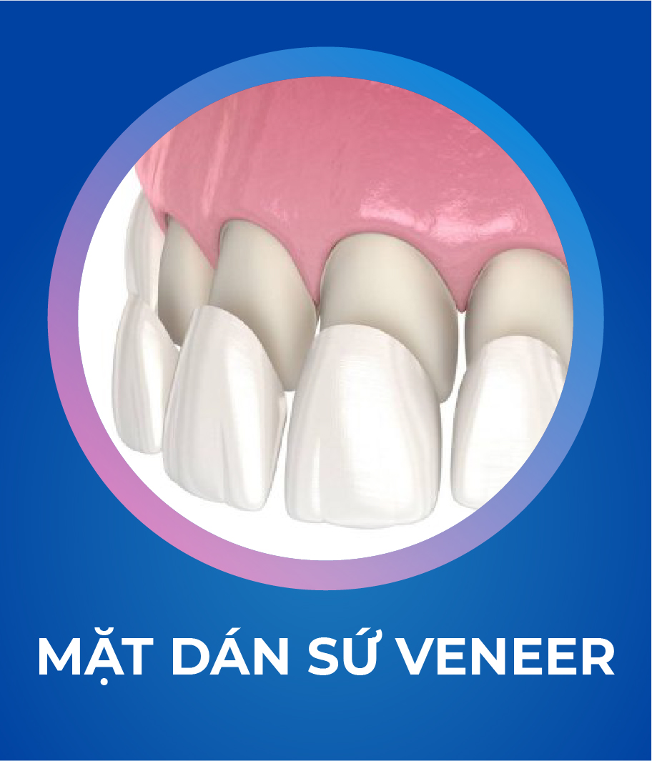 Dich vu Boc rang su 328 x 383 2 Tháng 4 15, 2026