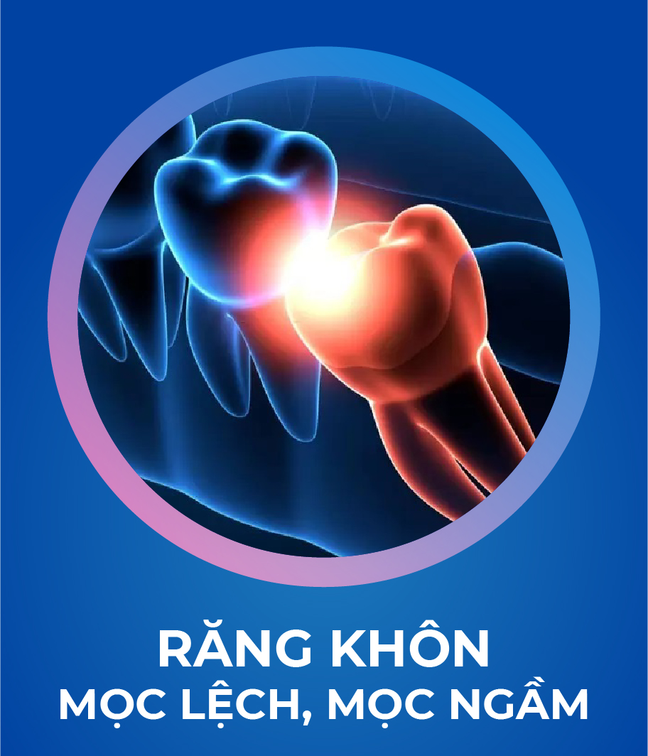 Dich vu Nho rang khon 328 x 383 1 Tháng 5 7, 2026