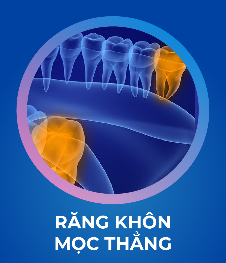 Dich vu Nho rang khon 328 x 383 1 1 Tháng 5 7, 2026