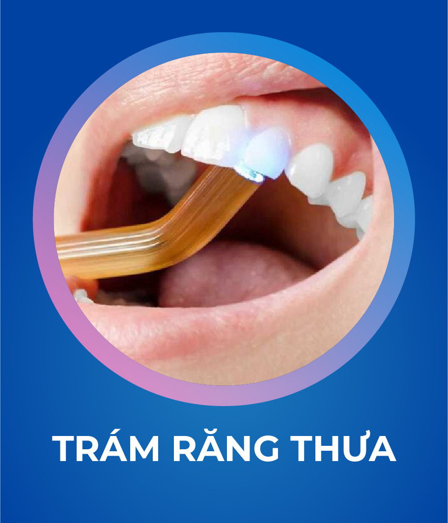 Dich vu Tram rang 328 x 383 1 Tháng mười một 18, 2025