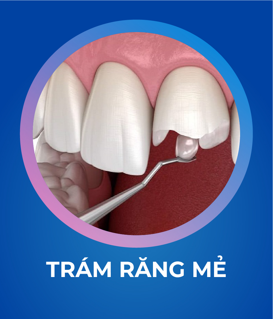 Dich vu Tram rang 328 x 383 1 1 Tháng mười một 18, 2025