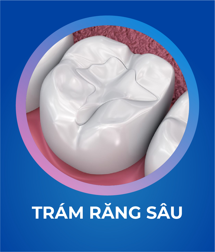 Dich vu Tram rang 328 x 383 2 1 Tháng mười một 18, 2025