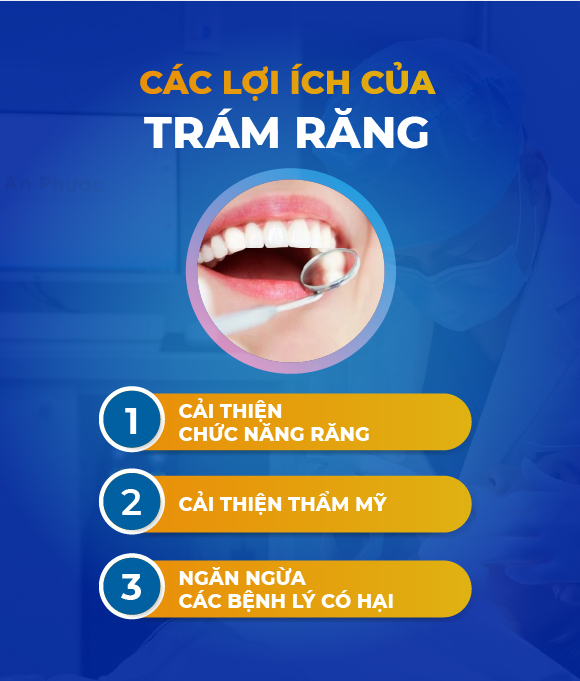 Dịch vụ Trám răng