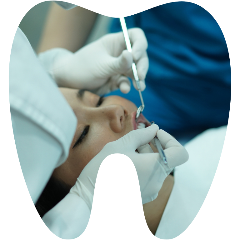 Gay te truoc khi nho rang khon Tháng 4 15, 2026