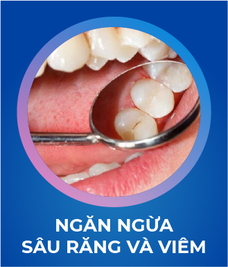 Ngăn ngừa sâu răng và viêm