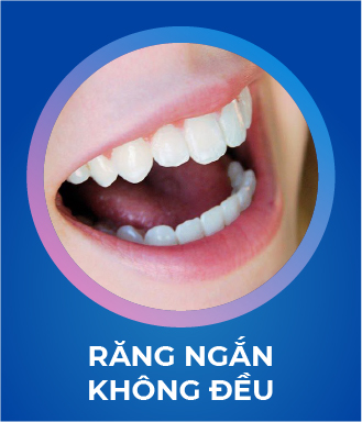 Răng ngắn không đều