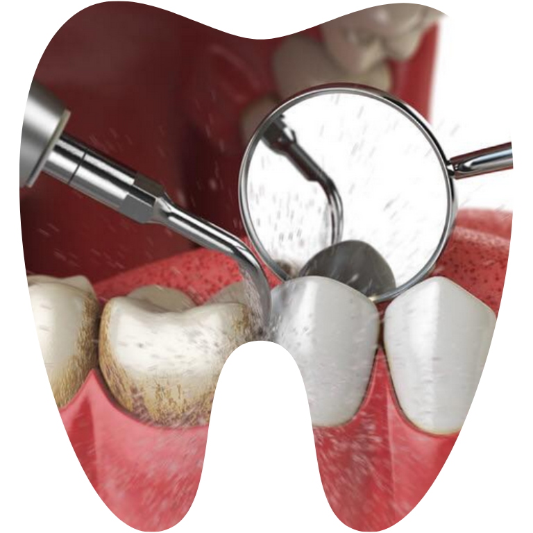 Tien hanh cao voi rang Tháng mười một 18, 2025