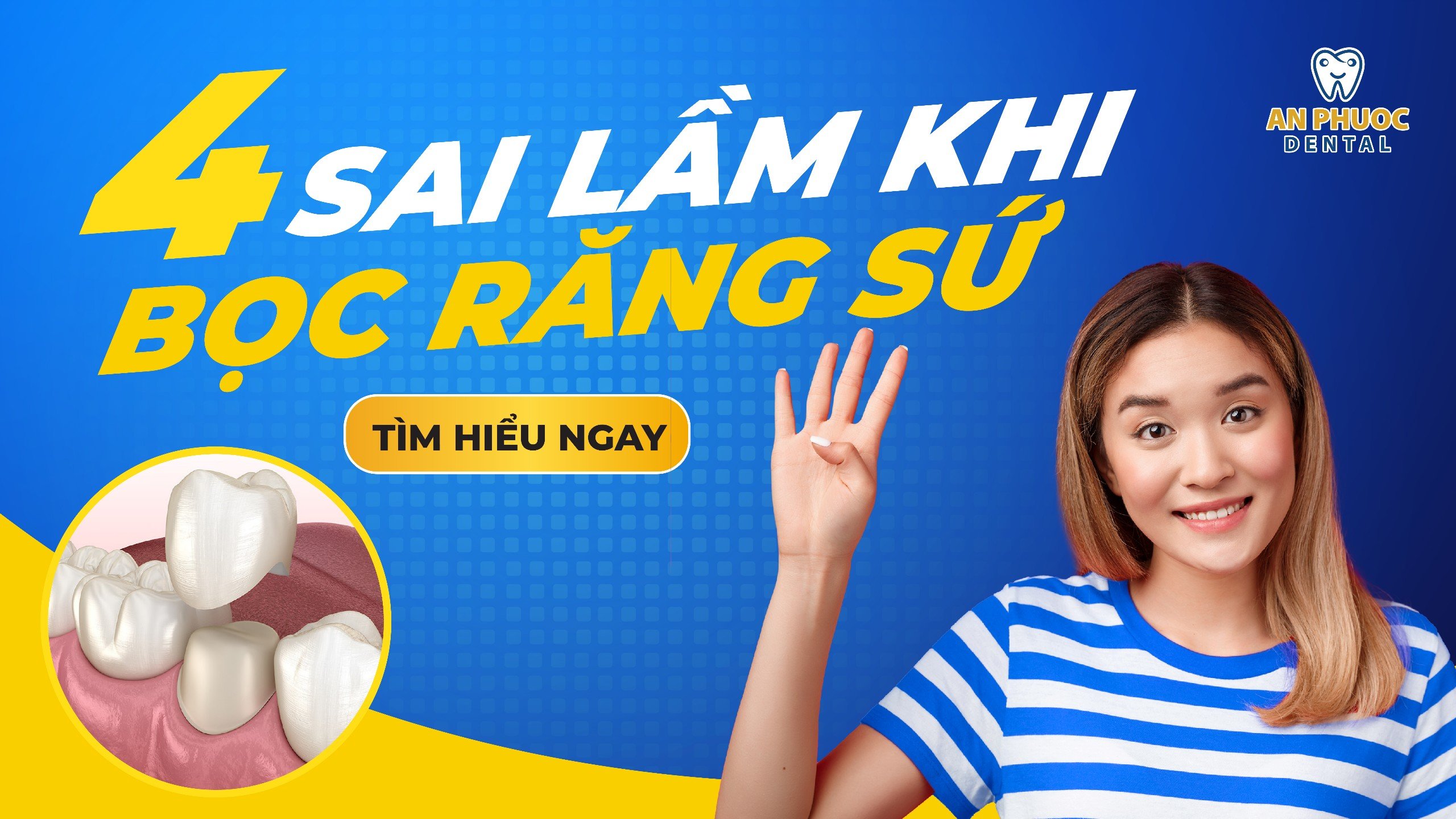 4 sai lầm khi bọc răng sứ dễ mắc phải và cách hạn chế 4 sai lầm khi bọc răng sứ