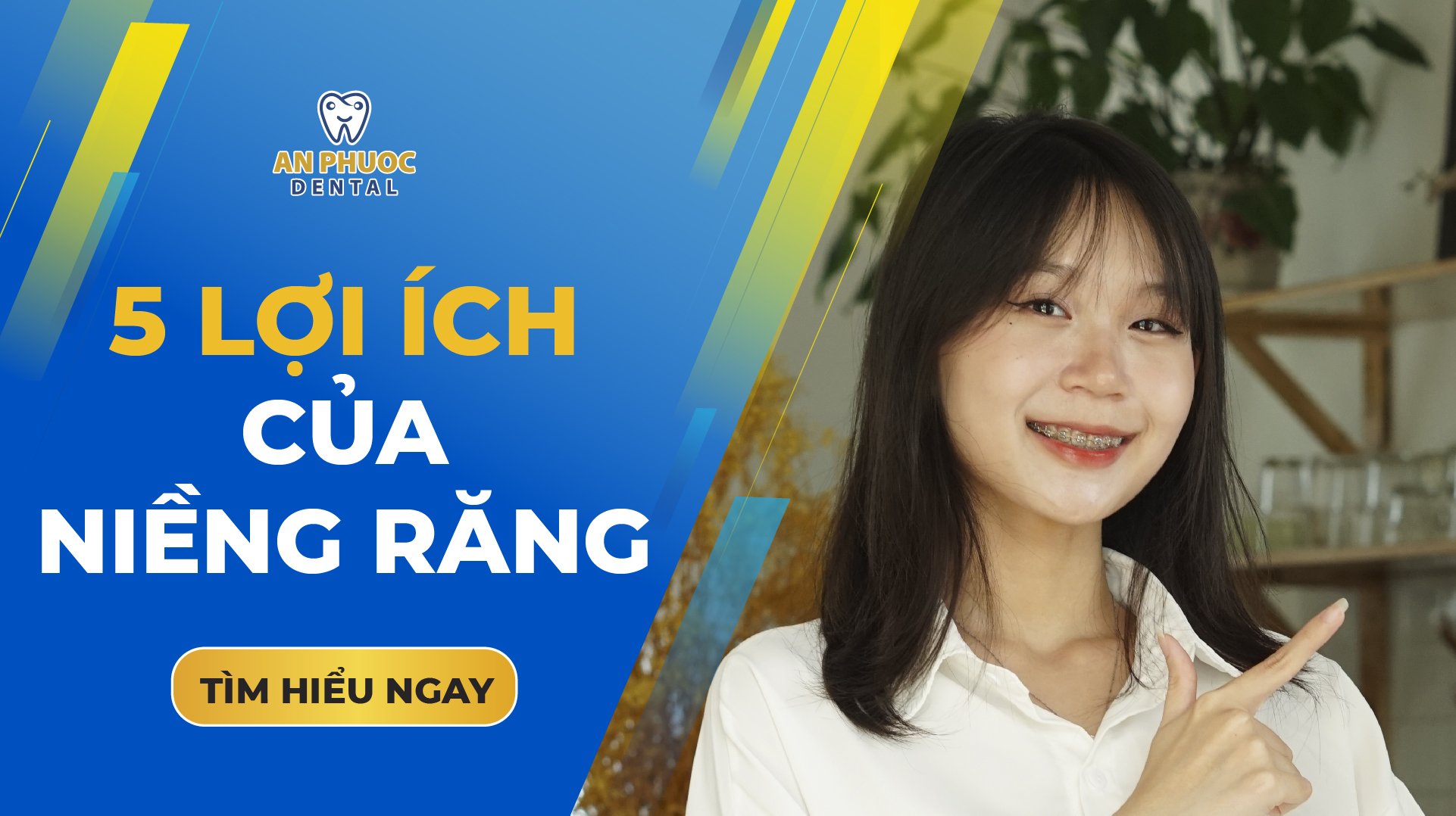 Niềng răng có tác dụng gì?