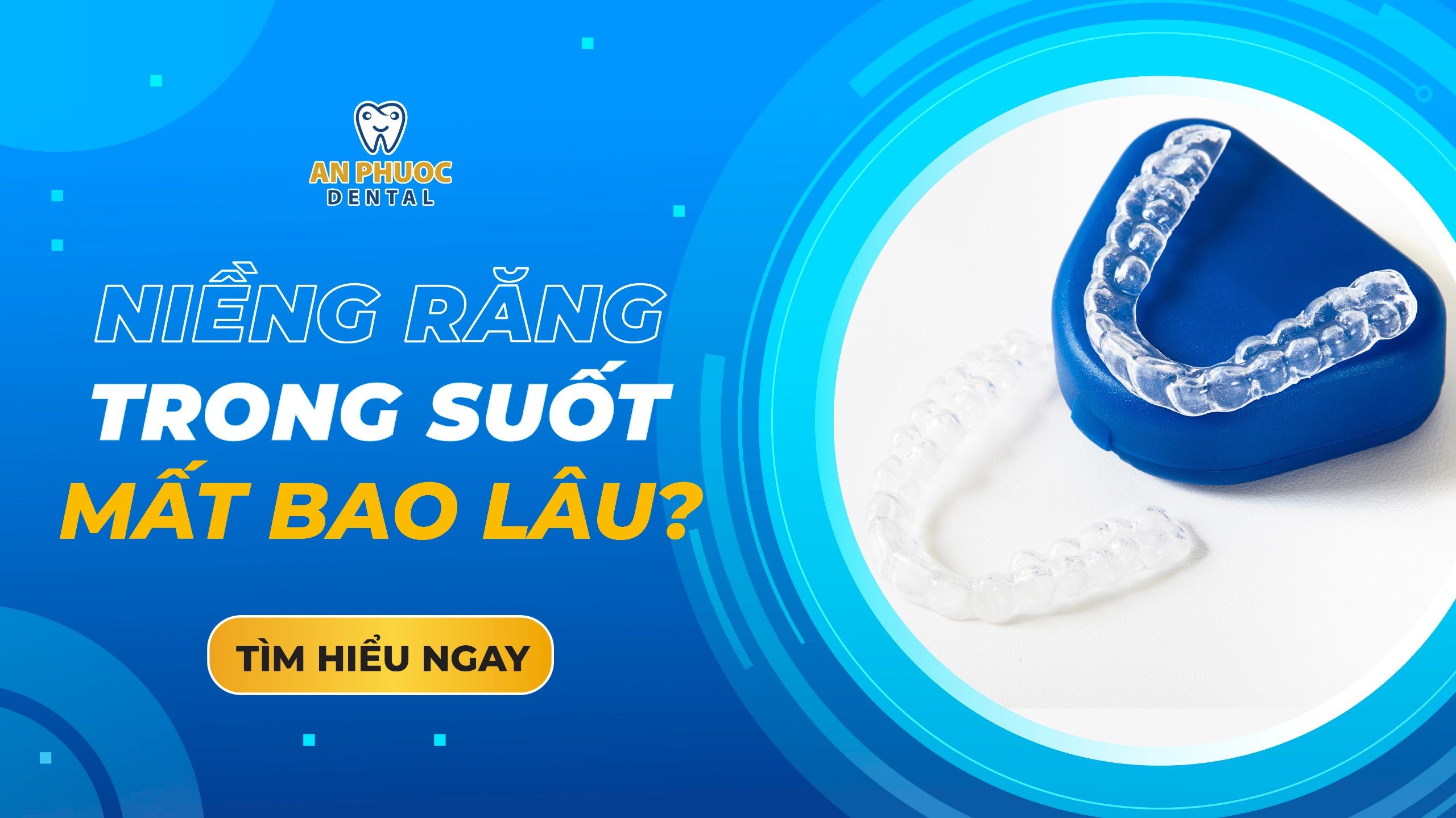 Niềng răng trong suốt mất bao lâu