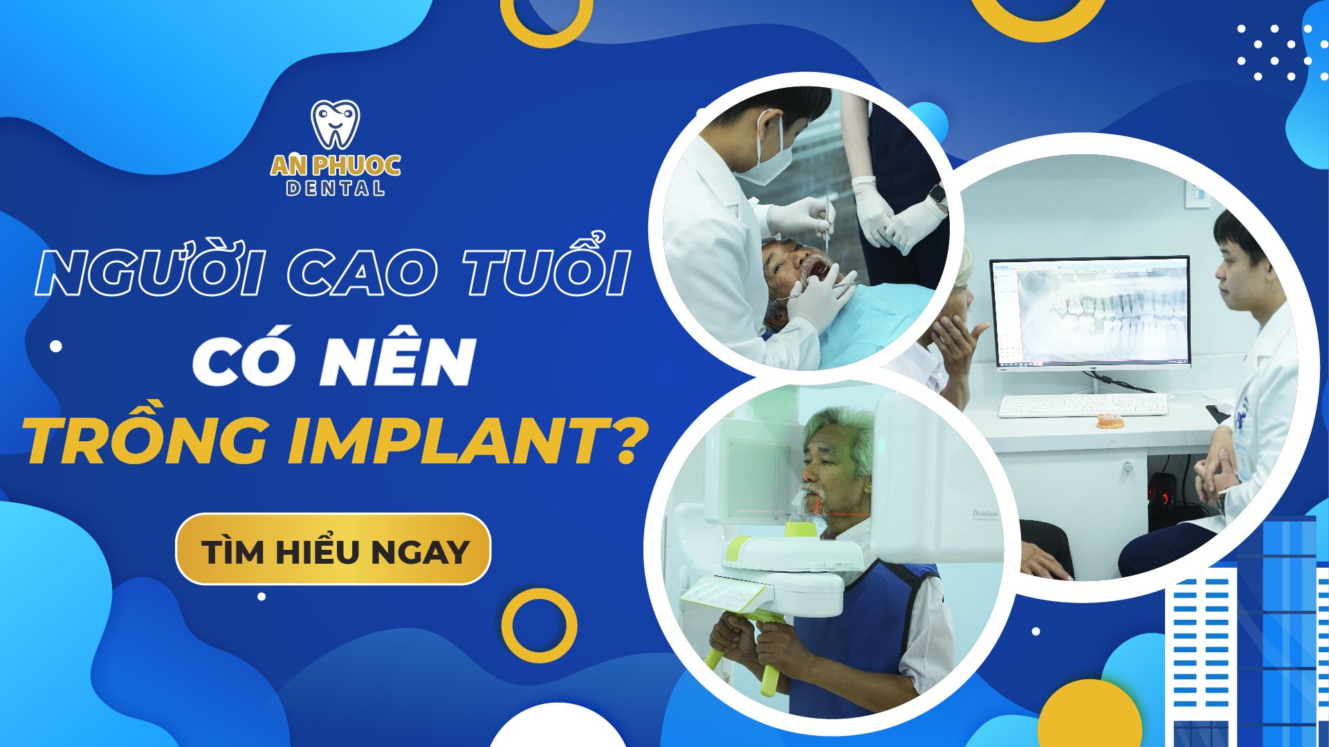 Trồng răng Implant cho người cao tuổi