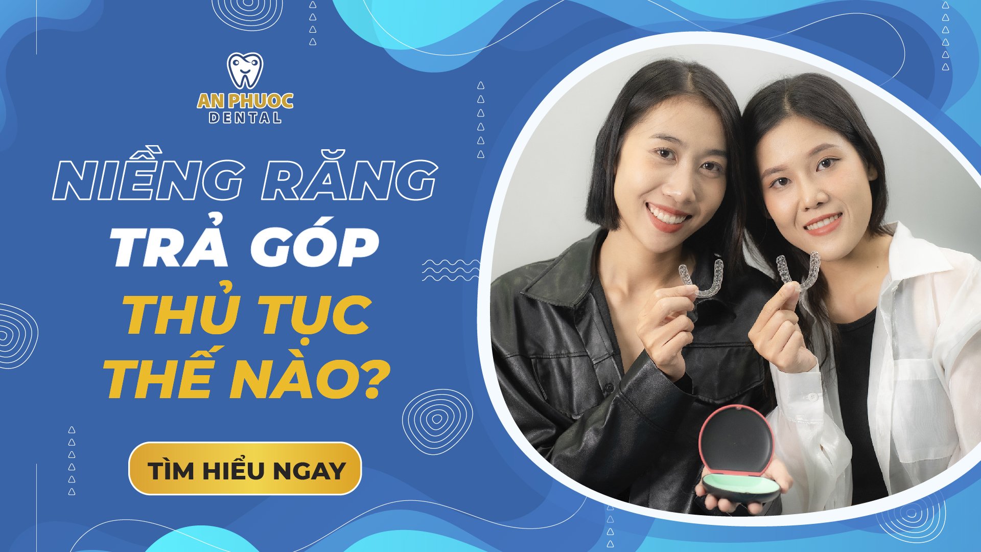 Review niềng răng trả góp như thế nào? Các thủ tục cần làm để trả góp Niềng răng trả góp thủ tục thế nào?