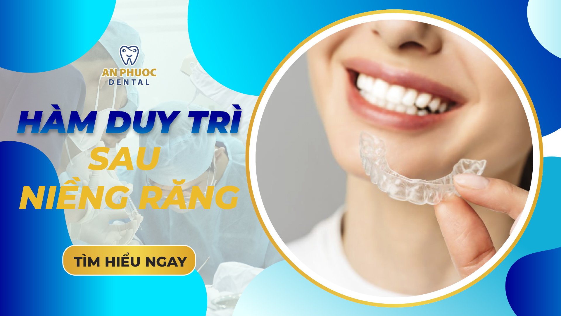 Hàm duy trì sau niềng răng