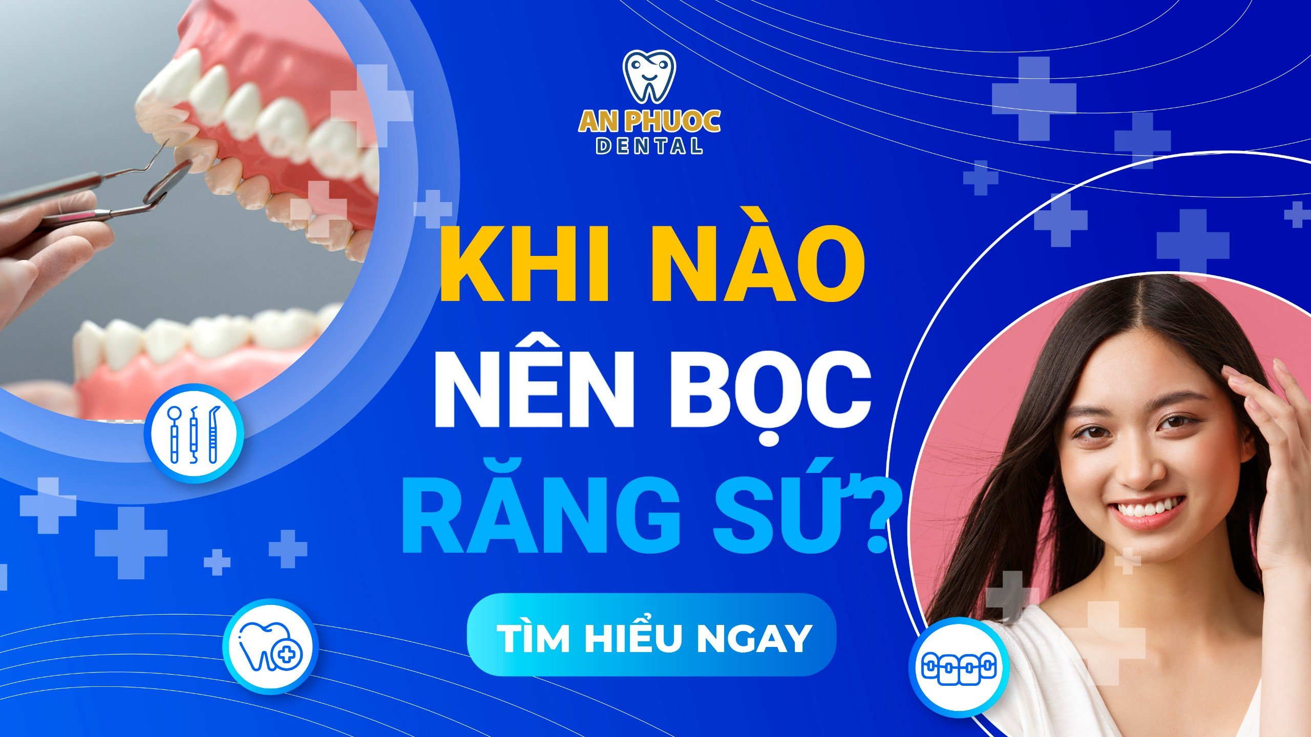 Khi nào nên bọc răng sứ? Lợi ích khi bọc răng sứ đúng lúc Khi nào nên bọc răng sứ? Lợi ích khi bọc răng sứ đúng lúc