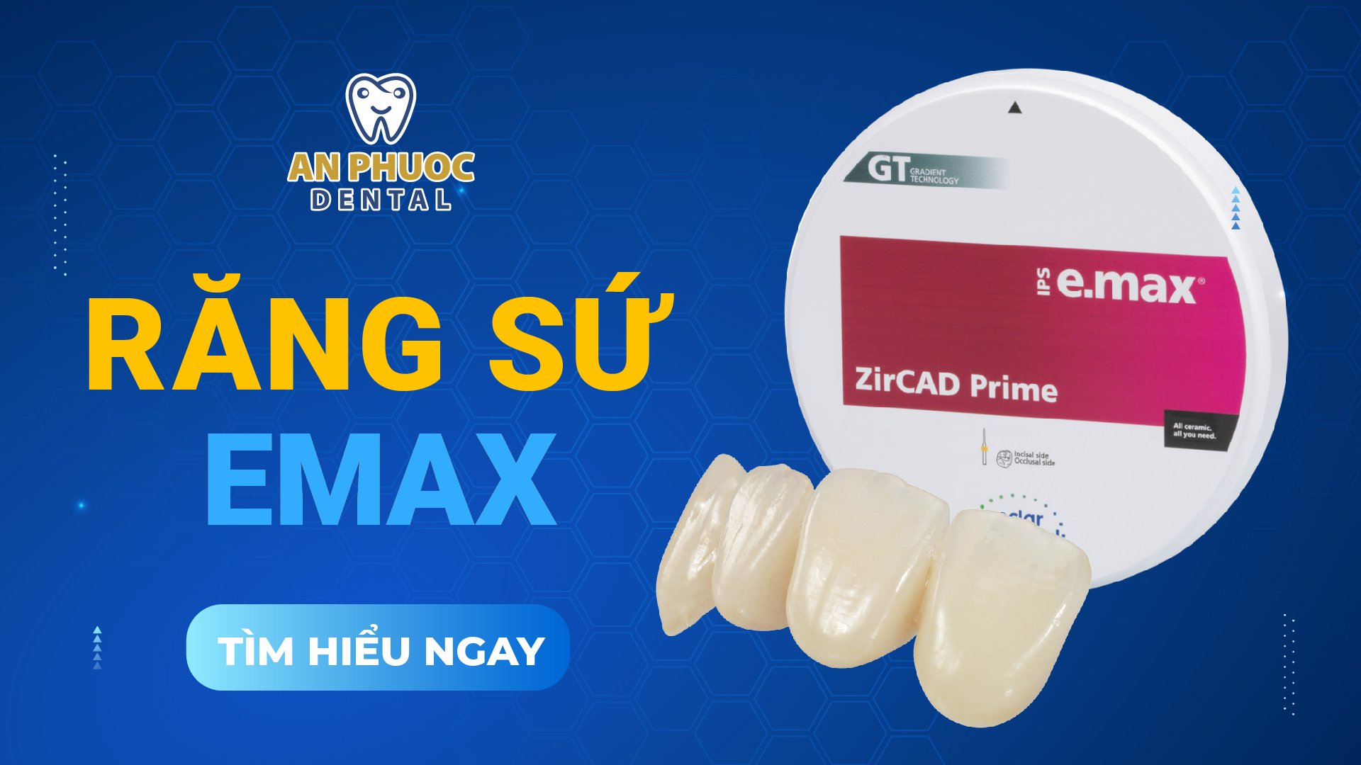 Răng sứ Emax là gì? Có tốt không? Giá bao nhiêu tiền? Răng sứ Emax là gì?