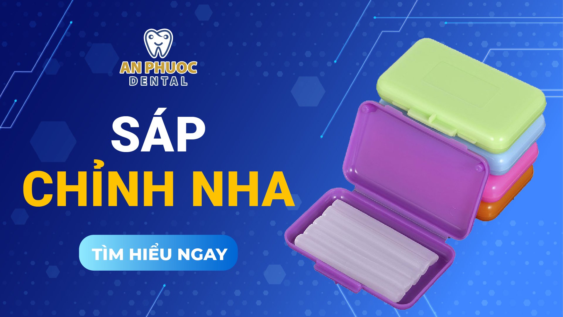 Sáp chỉnh nha là gì? Hướng dẫn cách dùng chuẩn cho người niềng răng Sáp chỉnh nha là gì? Hướng dẫn sử dụng