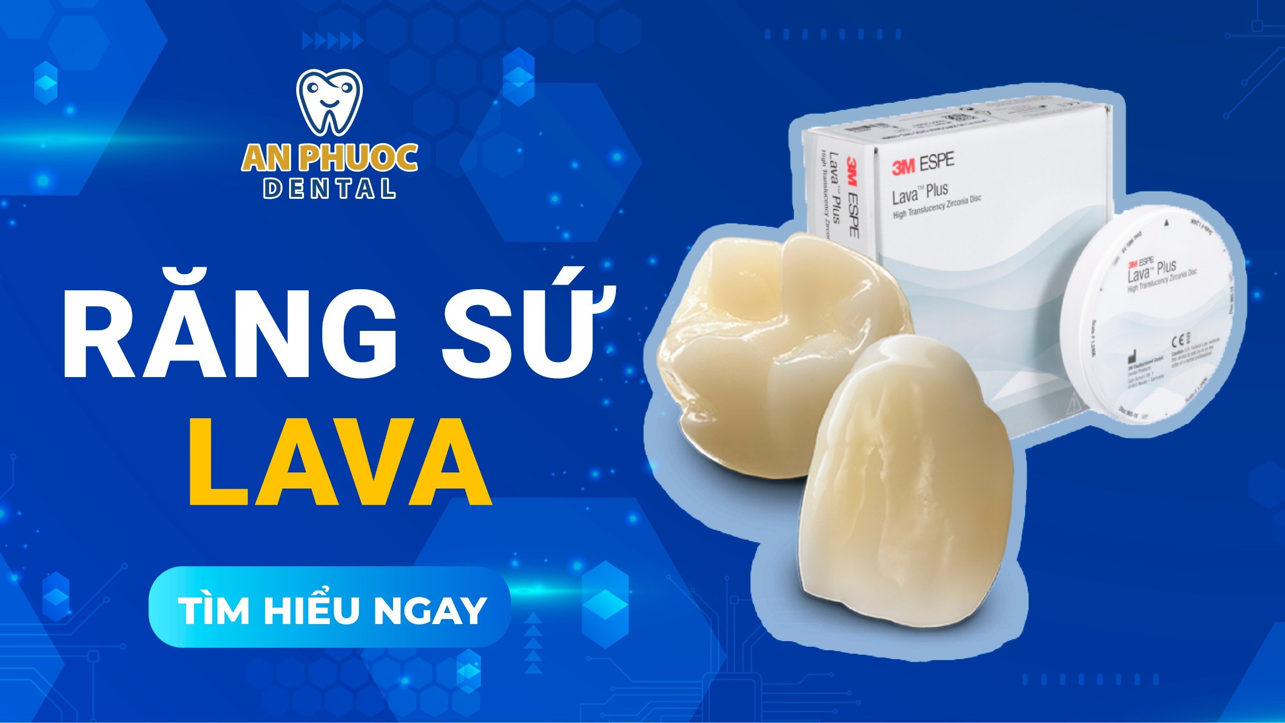 Các loại răng sứ Lava và bảng giá cập nhật 2025 Răng sứ Lava có mấy loại?