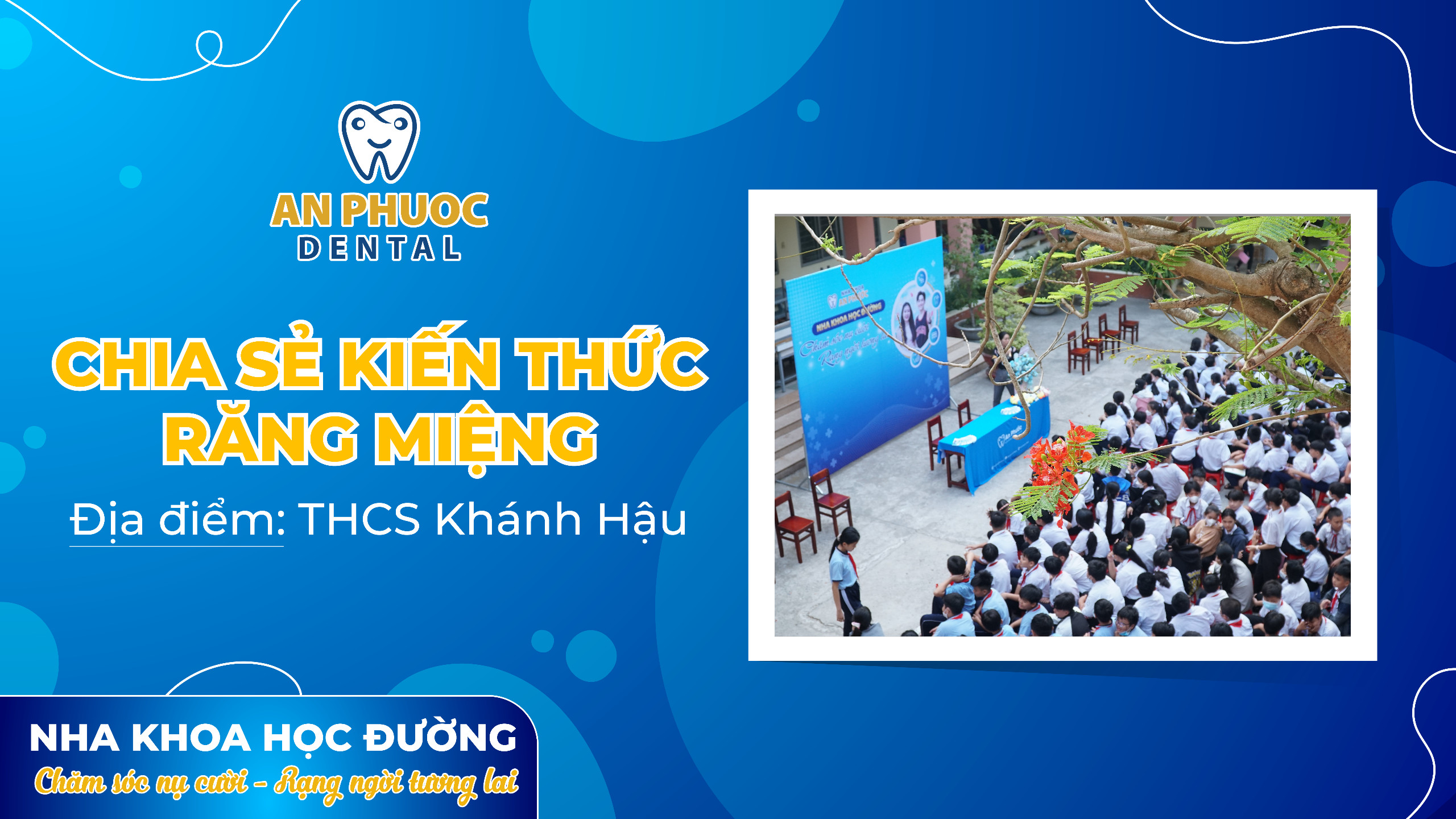 THCS Khánh Hậu - Lần đầu đồng hành cùng hành trình chăm sóc nụ cười THCS Khánh Hậu – Lần đầu đồng hành cùng hành trình chăm sóc nụ cười