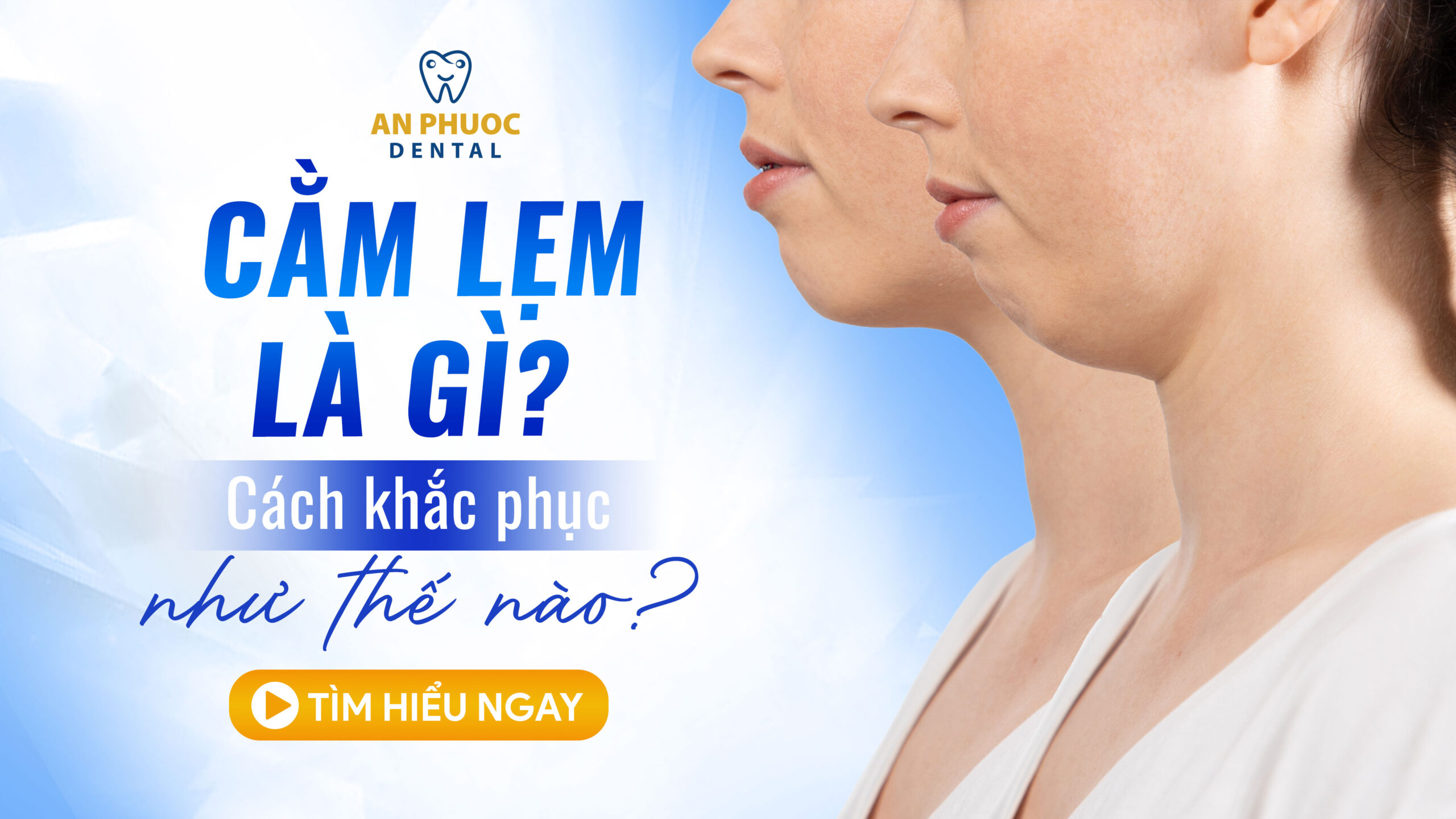 Dấu hiệu của cằm lẹm và phương pháp điều trị Cằm lẹm là gì? Khắc phục như thế nào?