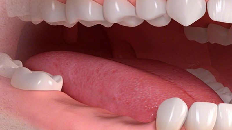 Mất răng hàm có bị hóp má không? Hậu quả và cách khắc phục Mất răng hàm có gây hóp má?