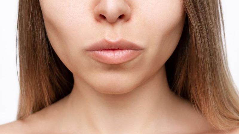 Mất răng hàm có bị hóp má không? Hậu quả và cách khắc phục Mất răng hàm lâu ngày sẽ khiến gương mặt mất cân đối