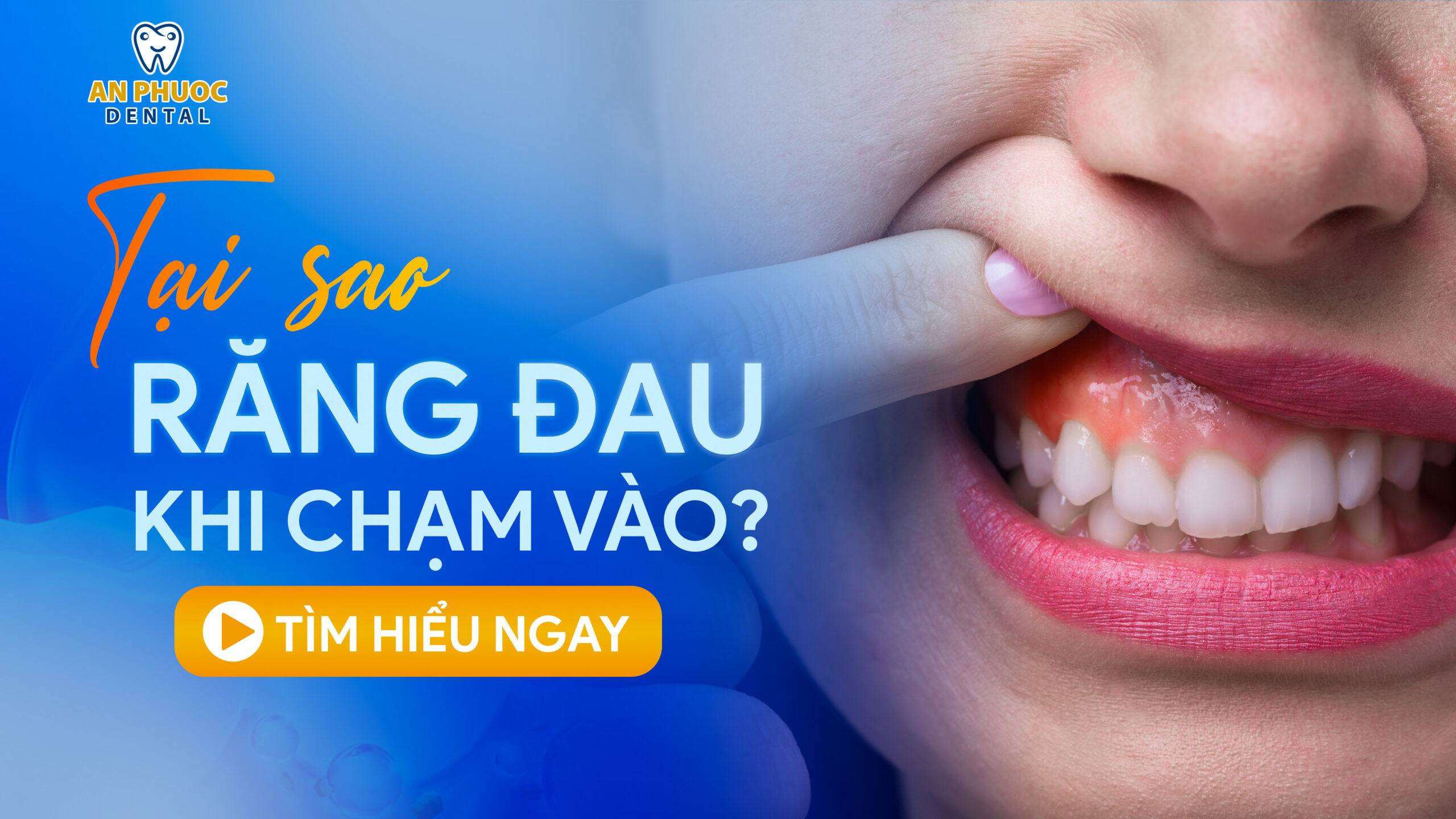Răng bị đau khi chạm vào có nguy hiểm không? Điều trị như thế nào? Tại sao răng đau khi chạm vào?