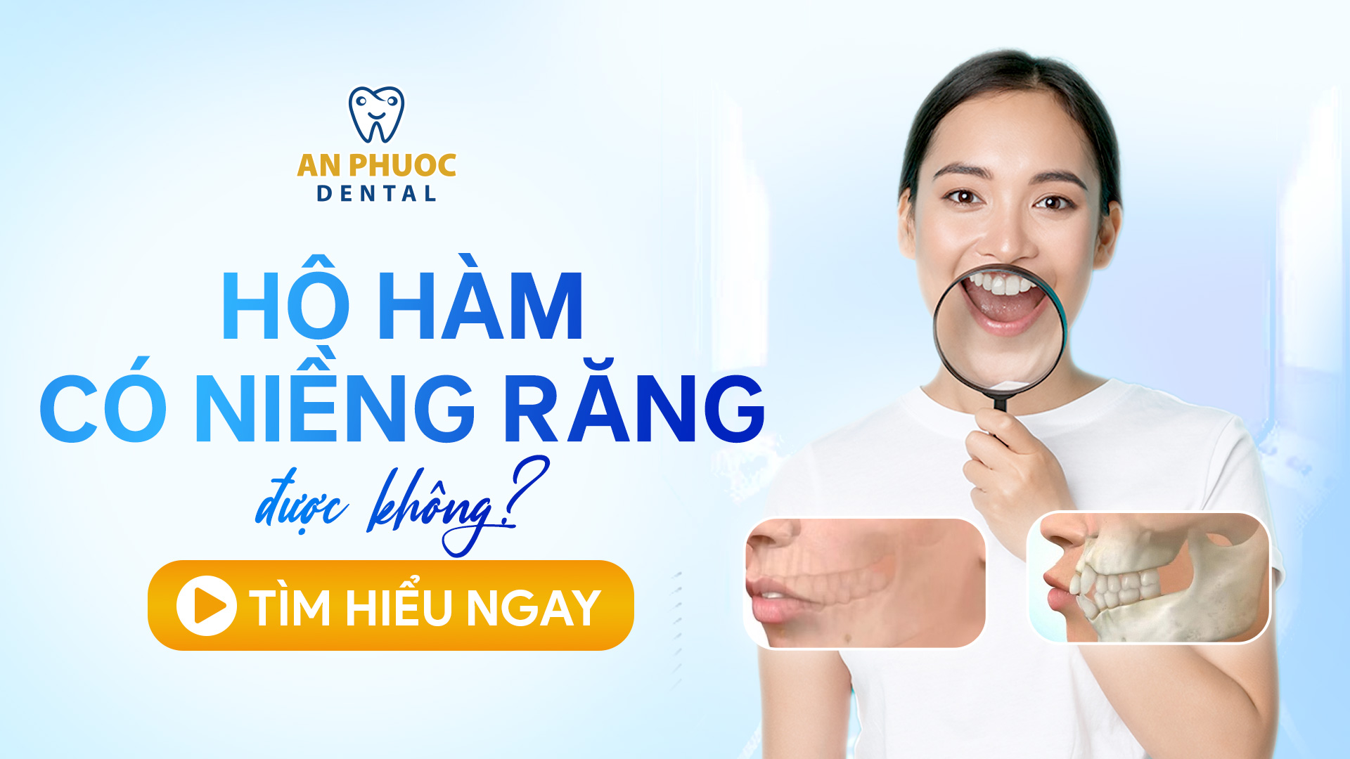 Hô hàm là gì? Hô hàm có niềng răng được không? Phương pháp điều trị Hô hàm có niềng răng được không?