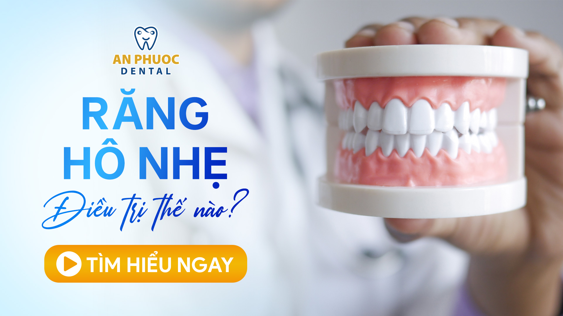 Thế nào là răng hô nhẹ? Cách khắc phục hiệu quả Răng hô nhẹ điều trị thế nào?