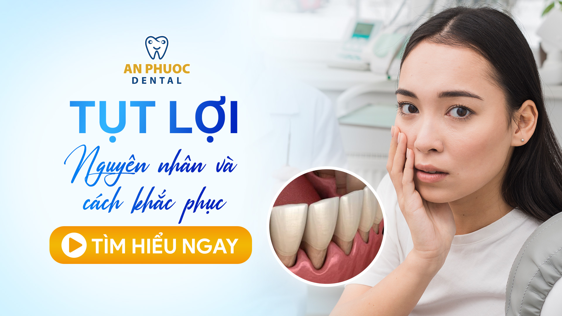 Bị tụt lợi có tự khỏi không? Cách chữa răng bị tụt lợi hiệu quả Tụt lợi - Nguyên nhân và cách khắc phục