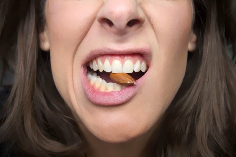 Lệch hàm: Nguyên nhân, tác hại và phương pháp điều trị hiệu quả Lệch hàm gây khó khăn cho quá trình ăn nhai và tiêu hoá