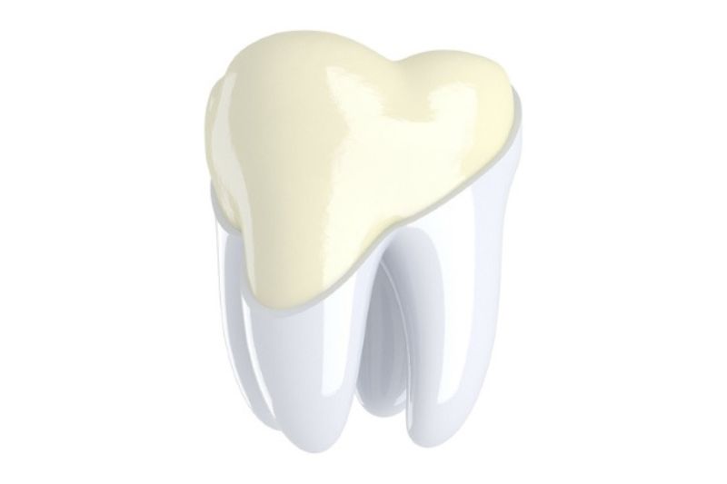 Mòn men răng là gì? Nguyên nhân và cách khắc phục kịp thời Mòn men răng gây lộ ngà răng, làm răng trở nên nhạy cảm hơn